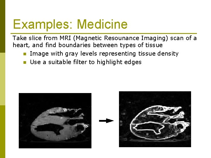 Examples: Medicine Take slice from MRI (Magnetic Resounance Imaging) scan of a heart, and Examples: Medicine Take slice from MRI (Magnetic Resounance Imaging) scan of a heart, and