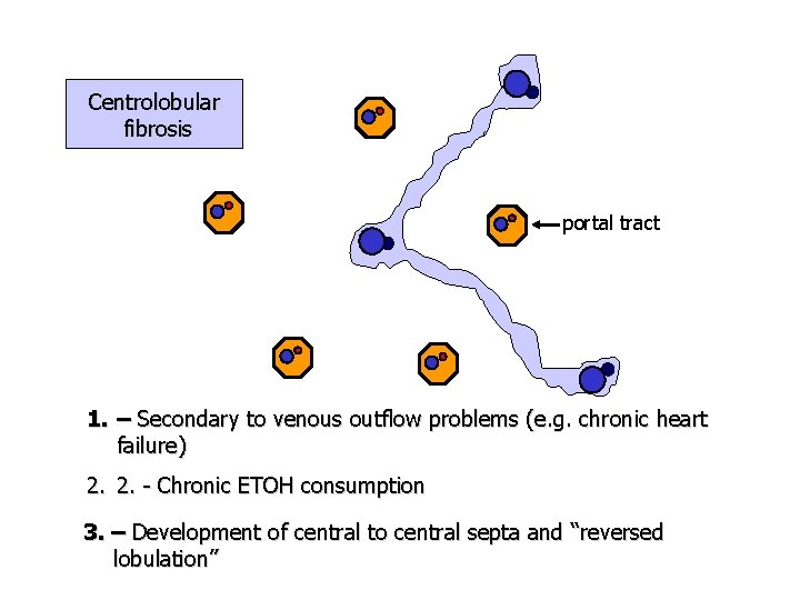 Centrolobular fibrosis portal tract 1. – Secondary to venous outflow problems (e. g. chronic