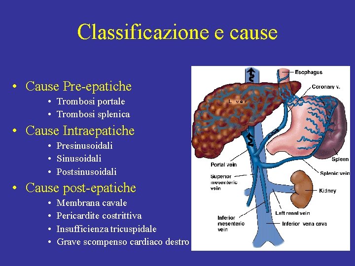 Classificazione e cause • Cause Pre-epatiche • Trombosi portale • Trombosi splenica • Cause
