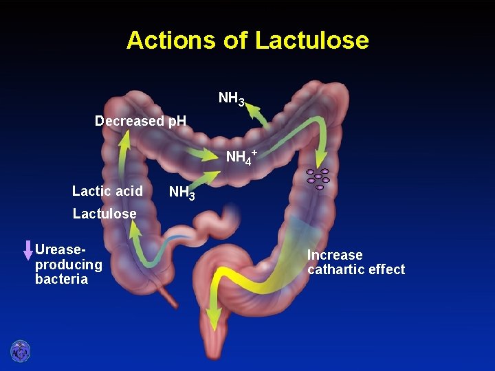 ACTIONS OF LACTULOSE Actions of Lactulose NH 3 Decreased p. H NH 4+ Lactic