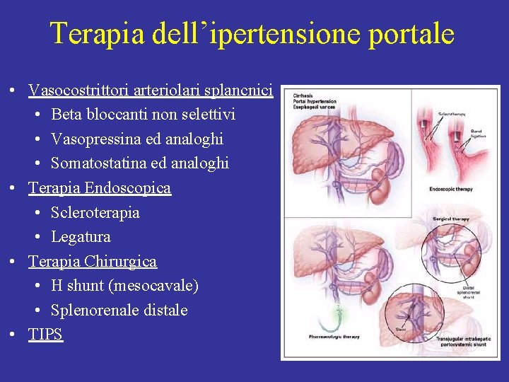 Terapia dell’ipertensione portale • Vasocostrittori arteriolari splancnici • Beta bloccanti non selettivi • Vasopressina