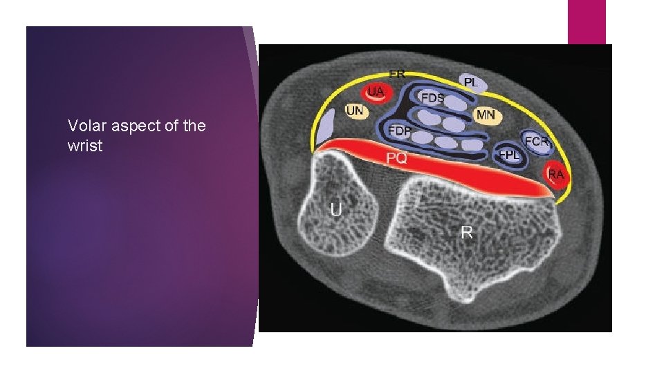 Volar aspect of the wrist 
