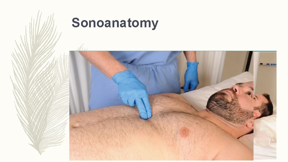 Sonoanatomy 