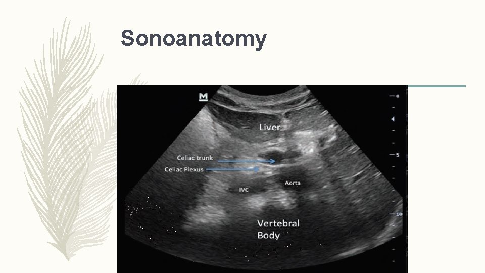 Sonoanatomy 