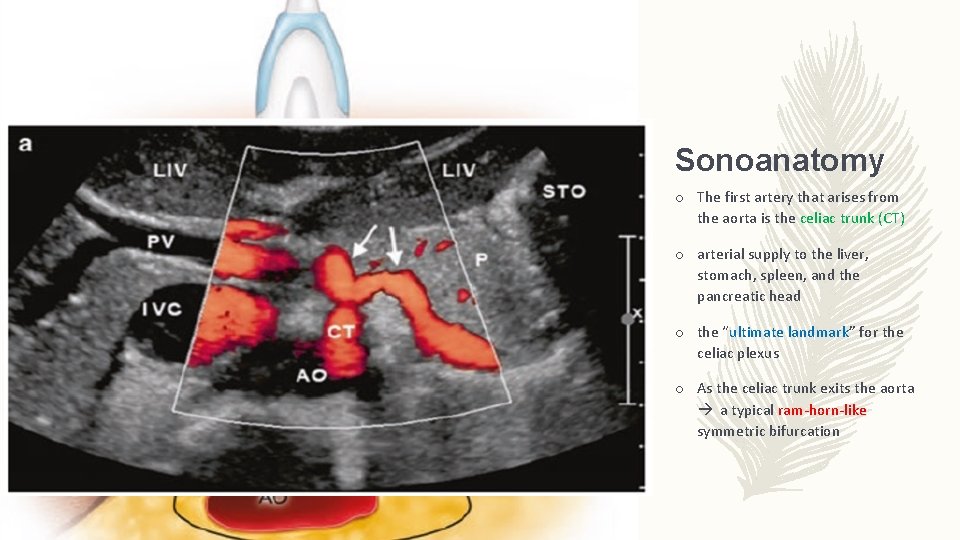 Sonoanatomy o The first artery that arises from the aorta is the celiac trunk