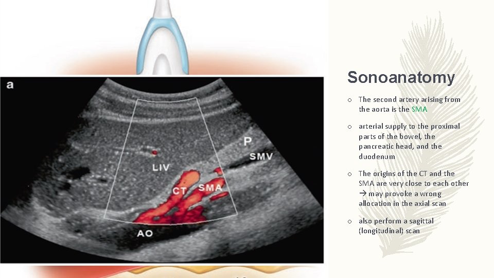 Sonoanatomy o The second artery arising from the aorta is the SMA o arterial
