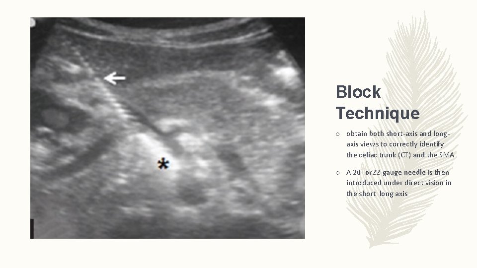 Block Technique o obtain both short-axis and longaxis views to correctly identify the celiac