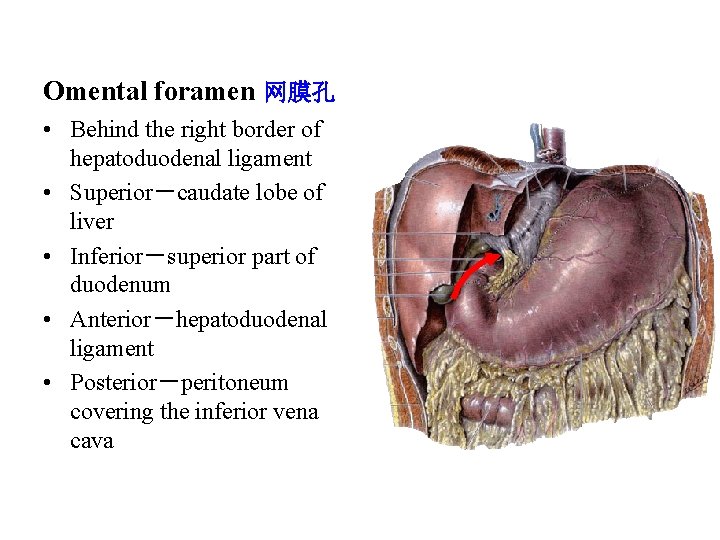 Omental foramen 网膜孔 • Behind the right border of hepatoduodenal ligament • Superior－caudate lobe