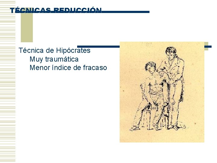 TÉCNICAS REDUCCIÓN Técnica de Hipócrates Muy traumática Menor índice de fracaso 