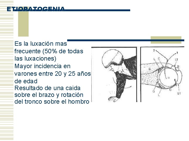 ETIOPATOGENIA Es la luxación mas frecuente (50% de todas luxaciones) Mayor incidencia en varones