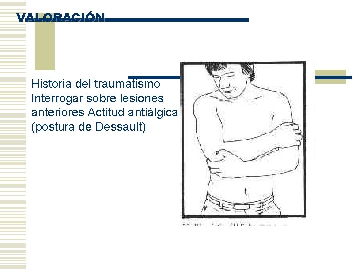 VALORACIÓN Historia del traumatismo Interrogar sobre lesiones anteriores Actitud antiálgica (postura de Dessault) 