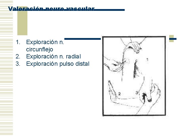 Valoración neuro vascular 1. Exploración n. circunflejo 2. Exploración n. radial 3. Exploración pulso