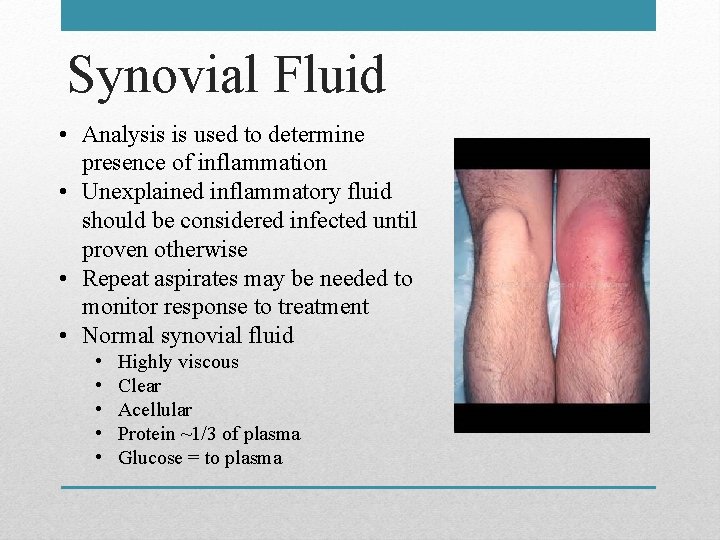 Synovial Fluid • Analysis is used to determine presence of inflammation • Unexplained inflammatory