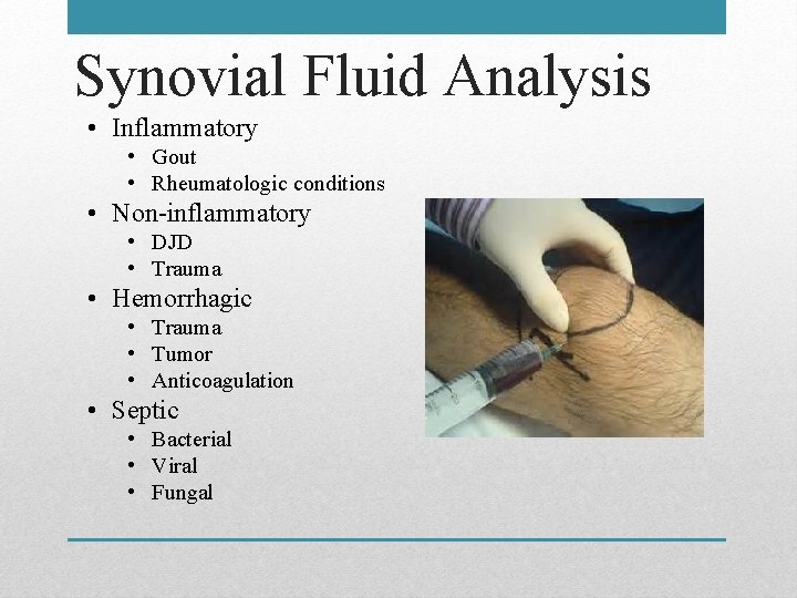 Synovial Fluid Analysis • Inflammatory • Gout • Rheumatologic conditions • Non-inflammatory • DJD