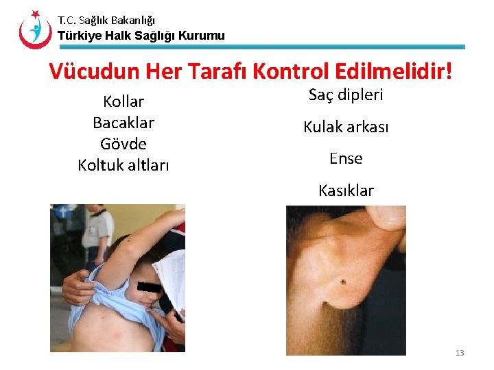 T. C. Sağlık Bakanlığı Türkiye Halk Sağlığı Kurumu Vücudun Her Tarafı Kontrol Edilmelidir! Kollar