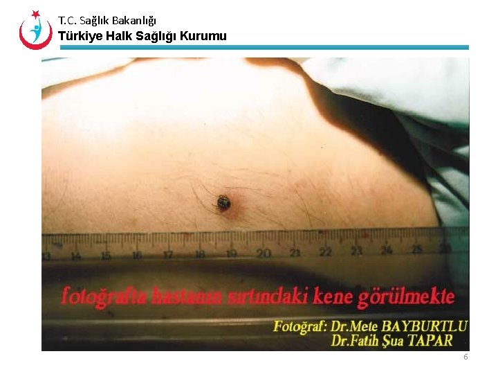 T. C. Sağlık Bakanlığı Türkiye Halk Sağlığı Kurumu 6 