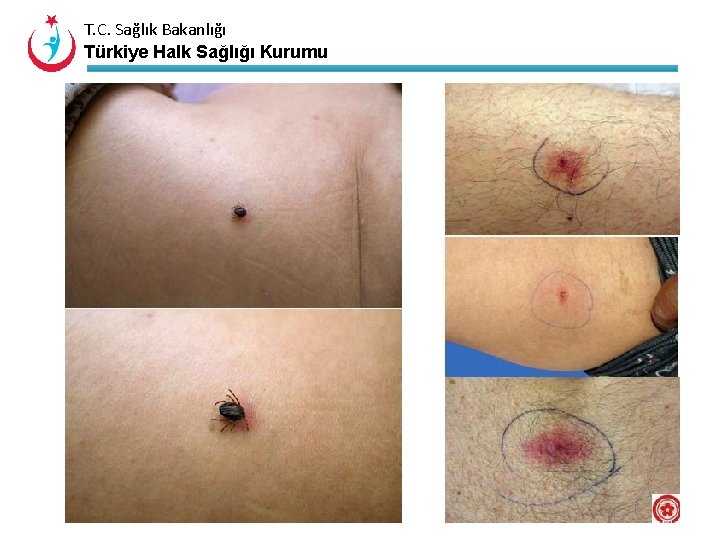 T. C. Sağlık Bakanlığı Türkiye Halk Sağlığı Kurumu 7 