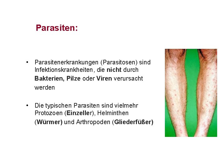 Parasiten: • Parasitenerkrankungen (Parasitosen) sind Infektionskrankheiten, die nicht durch Bakterien, Pilze oder Viren verursacht