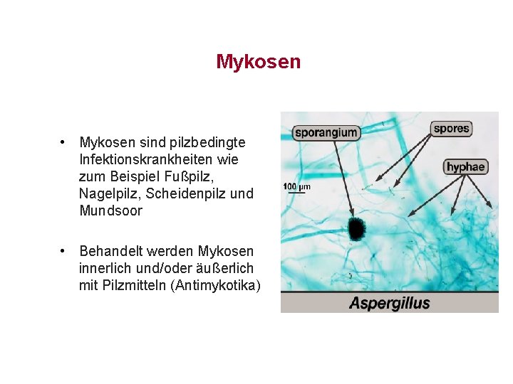 Mykosen • Mykosen sind pilzbedingte Infektionskrankheiten wie zum Beispiel Fußpilz, Nagelpilz, Scheidenpilz und Mundsoor