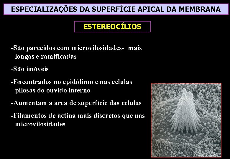 ESPECIALIZAÇÕES DA SUPERFÍCIE APICAL DA MEMBRANA ESTEREOCÍLIOS -São parecidos com microvilosidades- mais longas e ESPECIALIZAÇÕES DA SUPERFÍCIE APICAL DA MEMBRANA ESTEREOCÍLIOS -São parecidos com microvilosidades- mais longas e