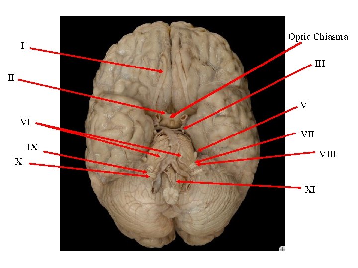 Optic Chiasma I II V VI VII IX VIII X XI 