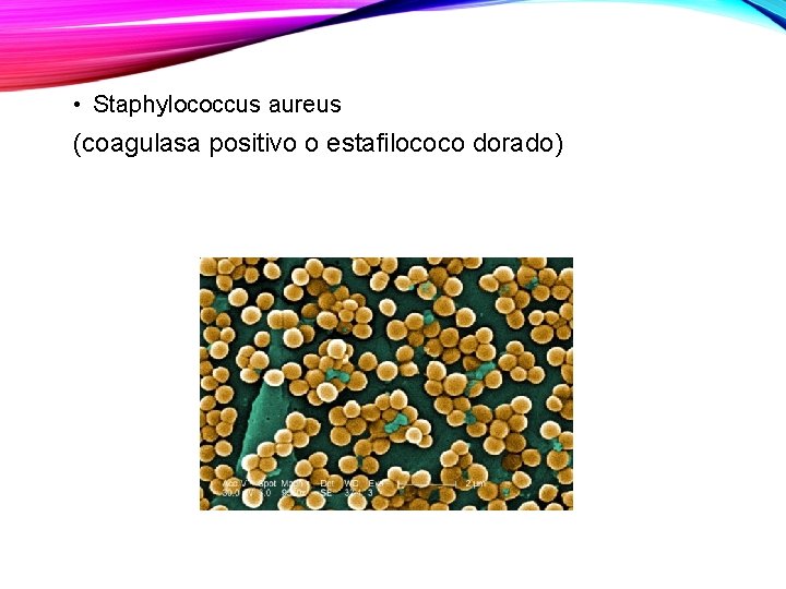  • Staphylococcus aureus (coagulasa positivo o estafilococo dorado) 