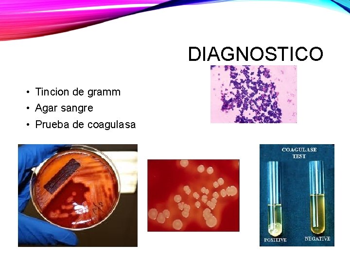 DIAGNOSTICO • Tincion de gramm • Agar sangre • Prueba de coagulasa 