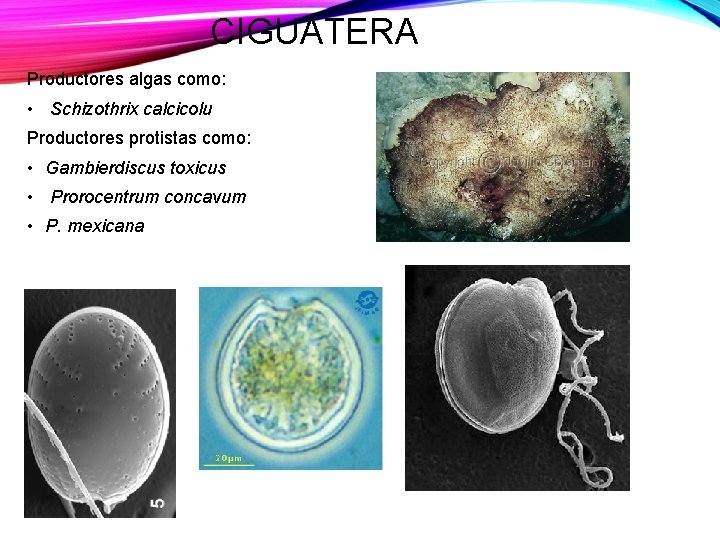 CIGUATERA Productores algas como: • Schizothrix calcicolu Productores protistas como: • Gambierdiscus toxicus •