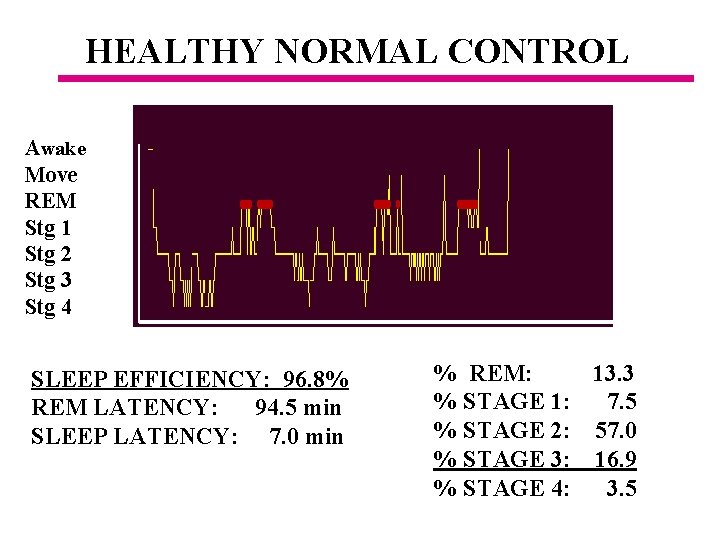 HEALTHY NORMAL CONTROL Awake Move REM Stg 1 Stg 2 Stg 3 Stg 4