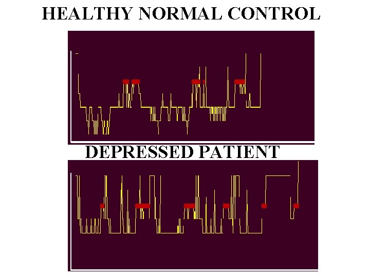 HEALTHY NORMAL CONTROL DEPRESSED PATIENT 