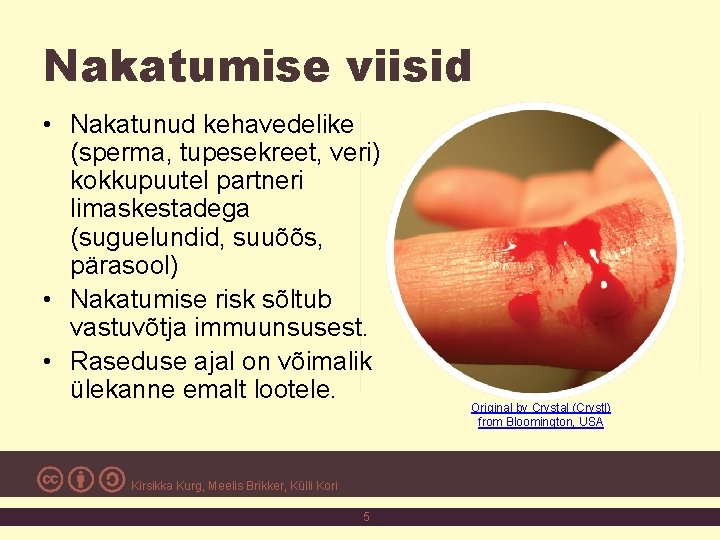 Nakatumise viisid • Nakatunud kehavedelike (sperma, tupesekreet, veri) kokkupuutel partneri limaskestadega (suguelundid, suuõõs, pärasool)