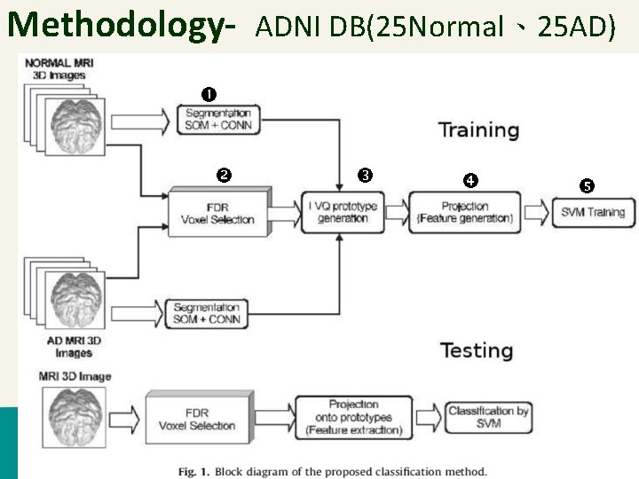 Methodology- ADNI DB(25 Normal、25 AD) Intelligent Database Systems Lab 