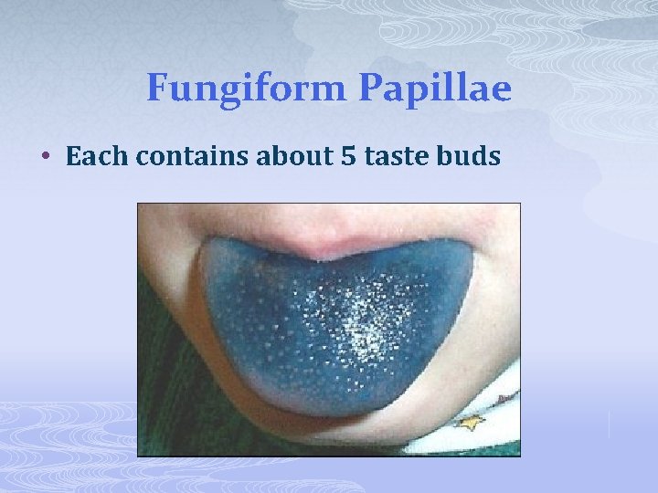Fungiform Papillae • Each contains about 5 taste buds 