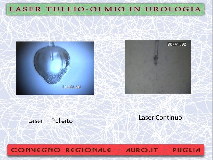 Laser Pulsato Laser Continuo 