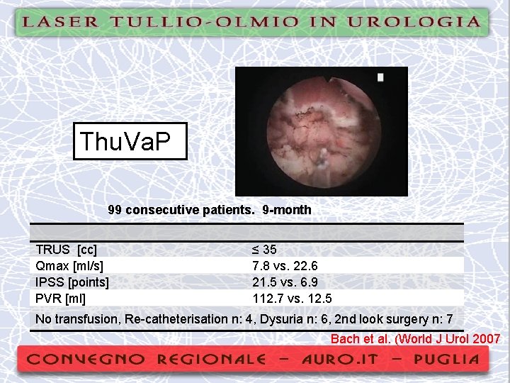 Thu. Va. P 99 consecutive patients. 9 -month TRUS [cc] Qmax [ml/s] IPSS [points]