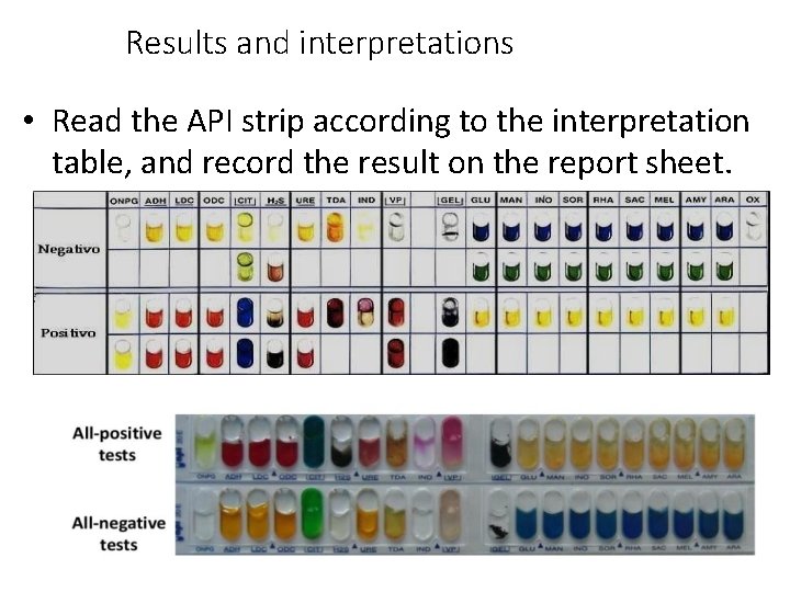 Results and interpretations • Read the API strip according to the interpretation table, and