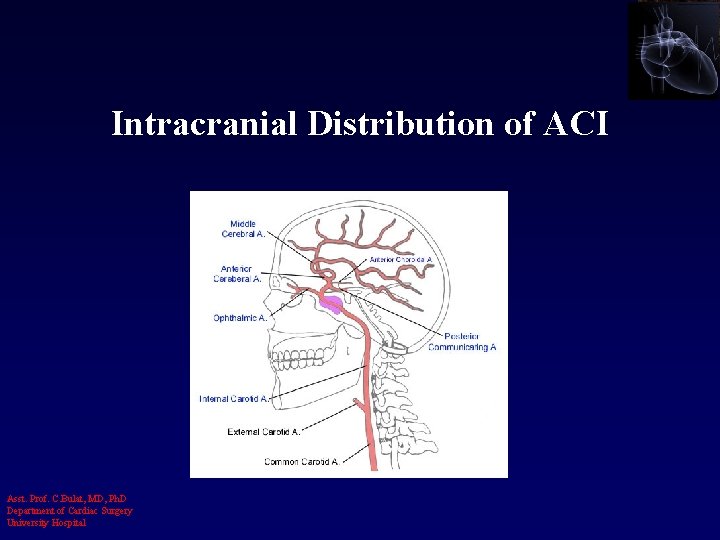 Intracranial Distribution of ACI Asst. Prof. C. Bulat, MD, Ph. D Department of Cardiac
