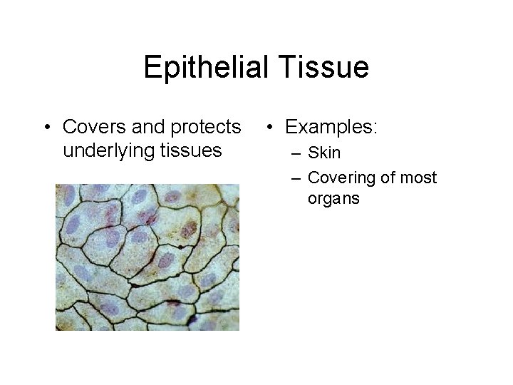 Epithelial Tissue • Covers and protects underlying tissues • Examples: – Skin – Covering