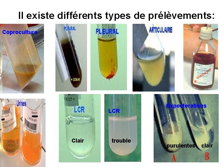 Il existe différents types de prélèvements: Coproculture LCR Clair trouble Expectorations purulentes clair 