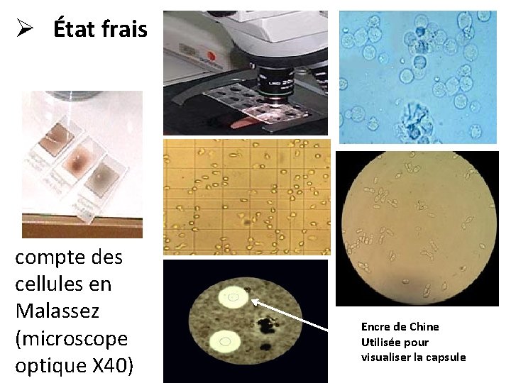 Ø État frais compte des cellules en Malassez (microscope optique X 40) Encre de