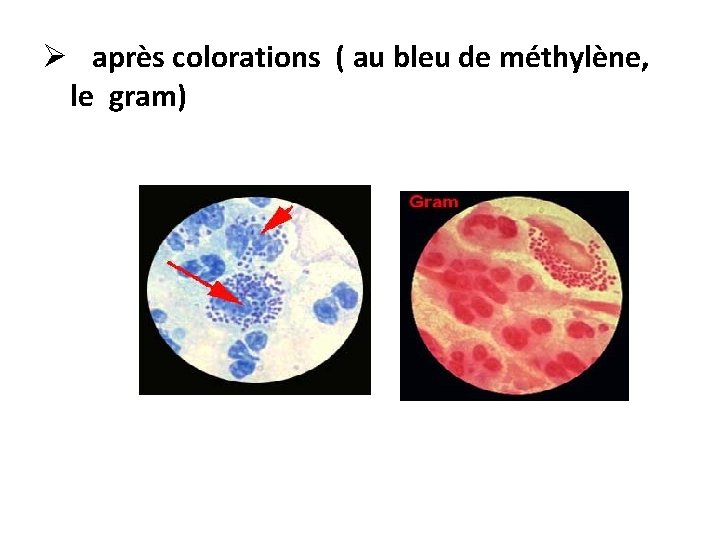 Ø après colorations ( au bleu de méthylène, le gram) 