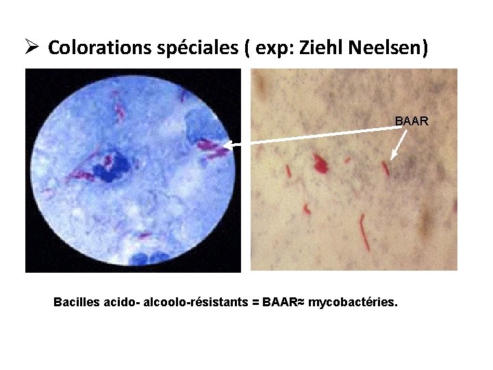 Ø Colorations spéciales ( exp: Ziehl Neelsen) BAAR Bacilles acido- alcoolo-résistants = BAAR≈ mycobactéries.