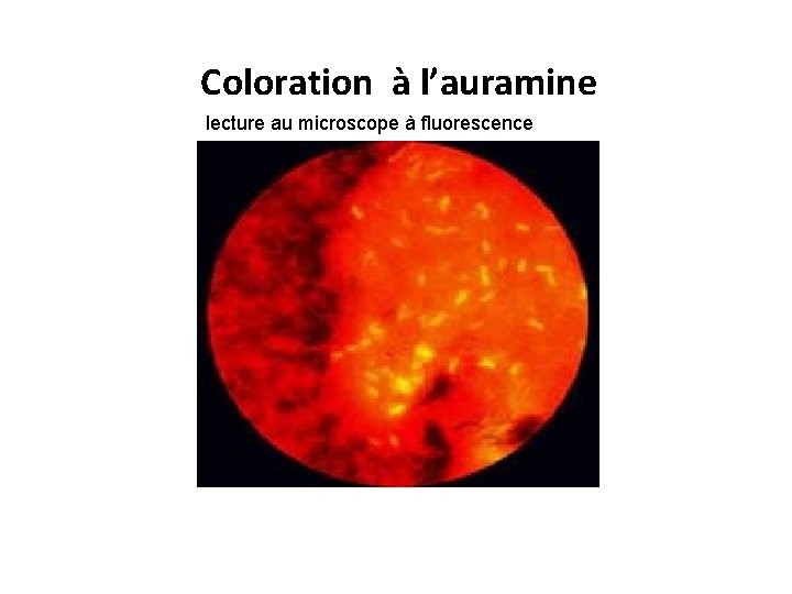 Coloration à l’auramine lecture au microscope à fluorescence 