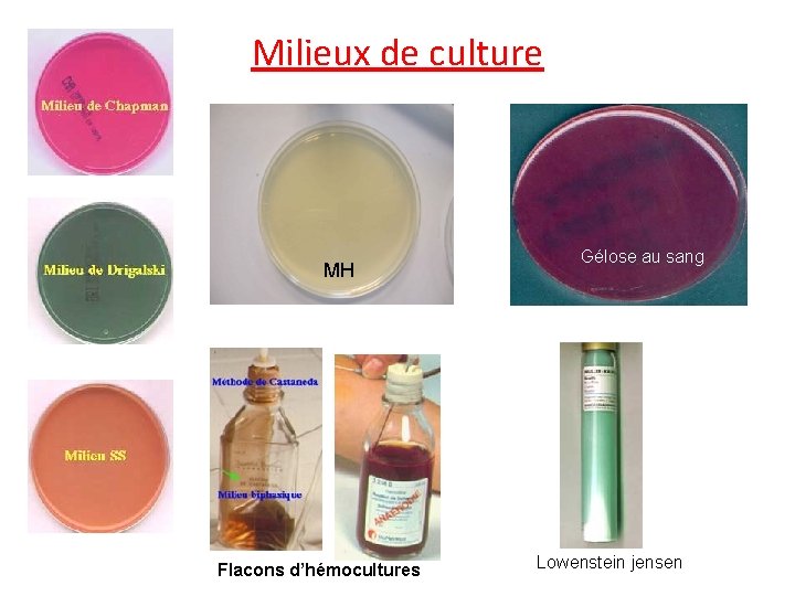 Milieux de culture MH Flacons d’hémocultures Gélose au sang Lowenstein jensen 