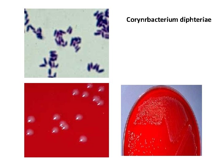 Corynrbacterium diphteriae 