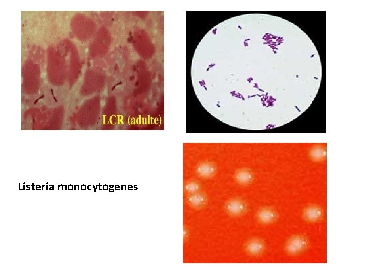 Listeria monocytogenes 