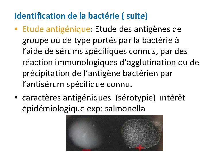 Identification de la bactérie ( suite) • Etude antigénique: Etude des antigènes de groupe