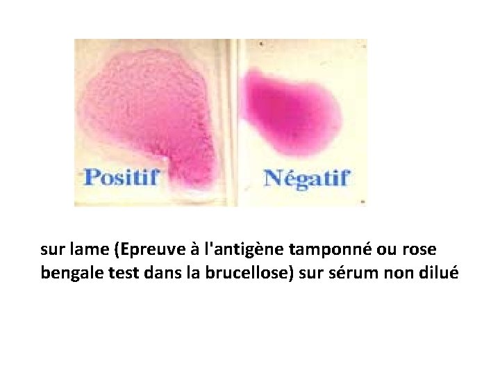 sur lame (Epreuve à l'antigène tamponné ou rose bengale test dans la brucellose) sur