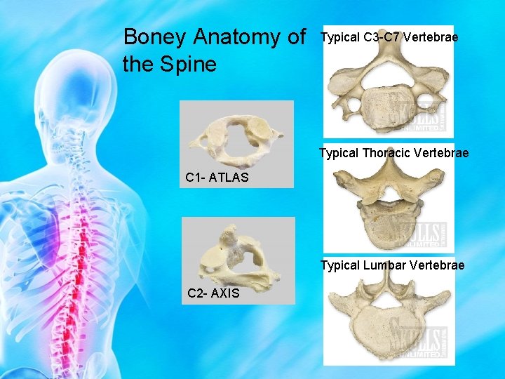 Boney Anatomy of the Spine Typical C 3 -C 7 Vertebrae Typical Thoracic Vertebrae