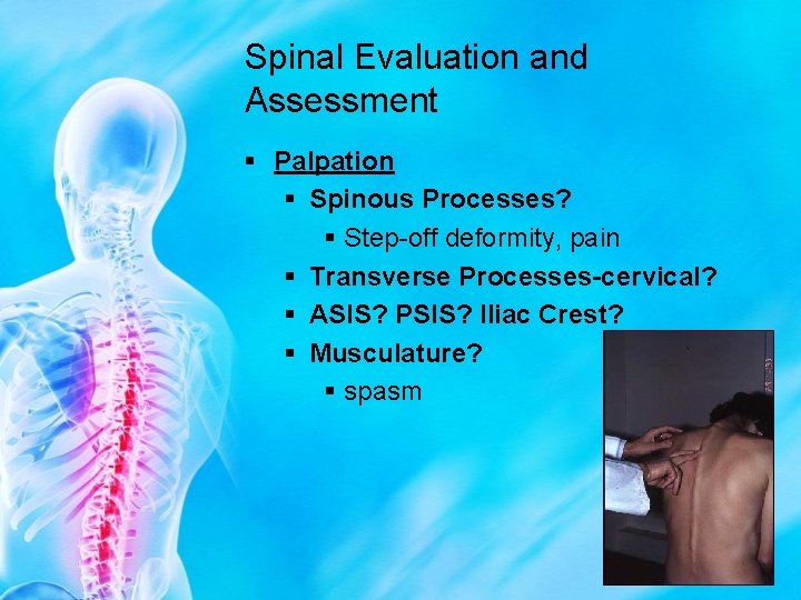 Spinal Evaluation and Assessment § Palpation § Spinous Processes? § Step-off deformity, pain §
